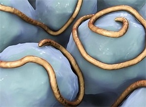 餐桌上的隐秘战争：食物寄生虫与人体免疫的攻防博弈