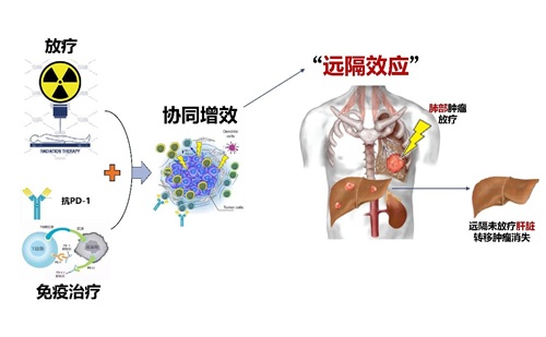 “双刃剑”变“助攻王”：放疗如何联手免疫治疗，打造抗癌新战线？